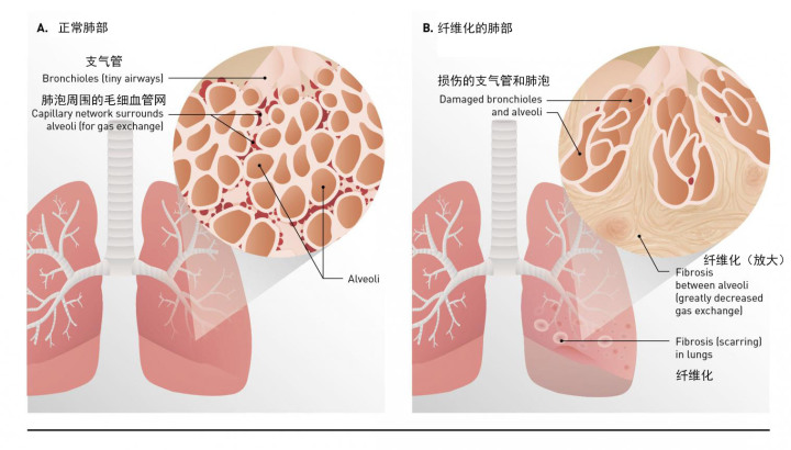 悦刻影响性功能吗？从香烟的影响来推测